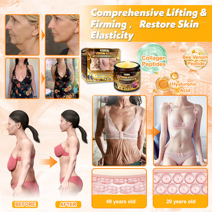 𝑯𝒊𝙢𝒊𝙡𝙠® 𝑩𝐞𝐞 𝑽𝙚𝙣𝙤𝙢 & 𝑻𝙖𝙡𝙡𝙤𝙬 𝑺𝐤𝐢𝐧 𝙍𝐞𝐬𝐭𝐨𝐫𝐚𝐭𝐢𝐨𝐧 𝘾𝐫𝐞𝐚𝐦 (Effective Within 7 Days)𝑩𝐞𝐞 𝑽𝙚𝙣𝙤𝙢 + 𝑻𝙖𝙡𝙡𝙤𝙬 · 7X Deep Hydration, targets wrinkles, sagging, stretch marks, dark spots, purpura, inflammations and more💧