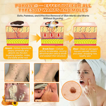 𝑯𝒊𝙢𝒊𝙡𝙠® 𝑩𝐞𝐞 𝑽𝙚𝙣𝙤𝙢 & 𝑻𝙖𝙡𝙡𝙤𝙬 𝑺𝐤𝐢𝐧 𝙍𝐞𝐬𝐭𝐨𝐫𝐚𝐭𝐢𝐨𝐧 𝘾𝐫𝐞𝐚𝐦 (Effective Within 7 Days)𝑩𝐞𝐞 𝑽𝙚𝙣𝙤𝙢 + 𝑻𝙖𝙡𝙡𝙤𝙬 · 7X Deep Hydration, targets wrinkles, sagging, stretch marks, dark spots, purpura, inflammations and more💧