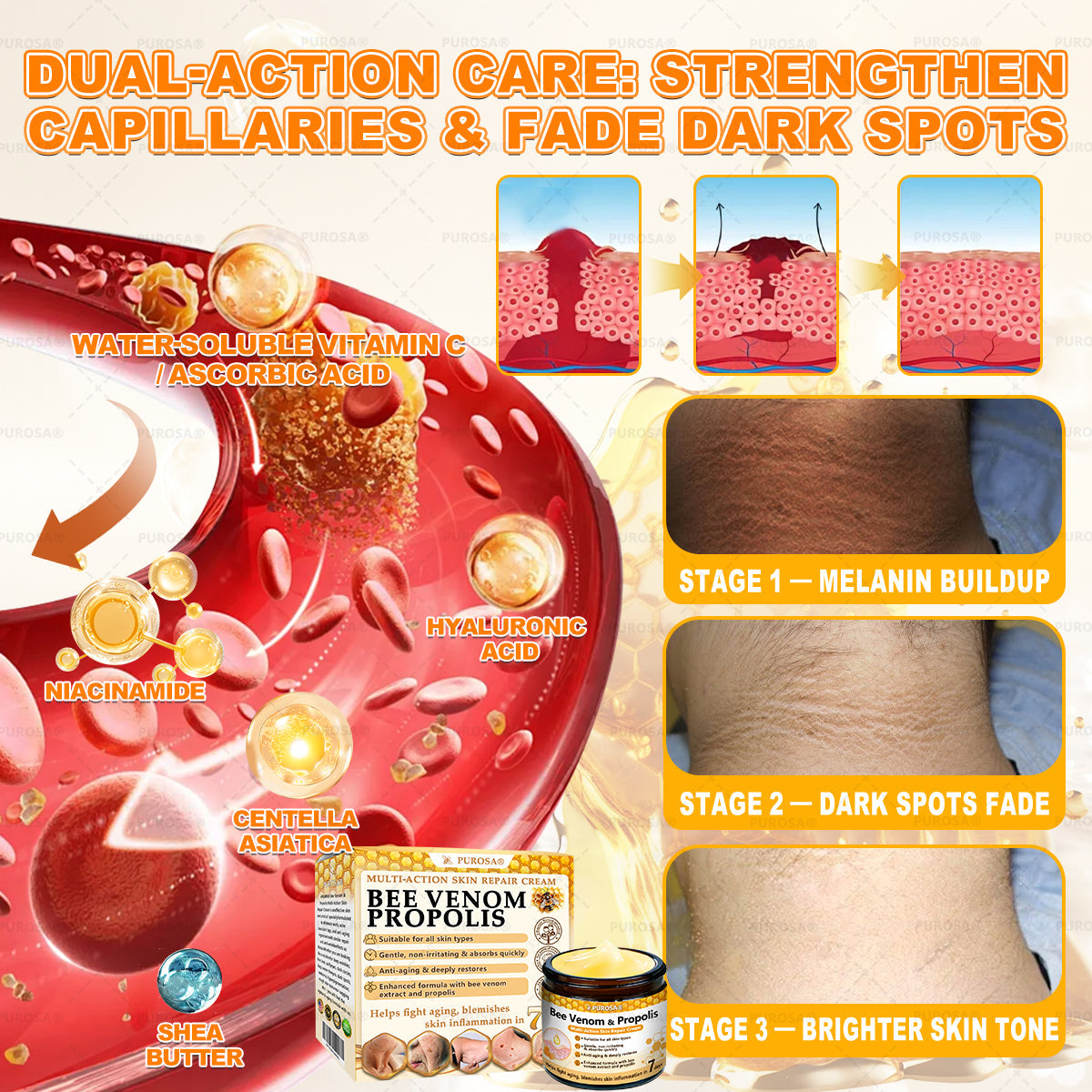 𝑯𝒊𝙢𝒊𝙡𝙠® 𝑩𝐞𝐞 𝑽𝙚𝙣𝙤𝙢 & 𝑻𝙖𝙡𝙡𝙤𝙬 𝑺𝐤𝐢𝐧 𝙍𝐞𝐬𝐭𝐨𝐫𝐚𝐭𝐢𝐨𝐧 𝘾𝐫𝐞𝐚𝐦 (Effective Within 7 Days)𝑩𝐞𝐞 𝑽𝙚𝙣𝙤𝙢 + 𝑻𝙖𝙡𝙡𝙤𝙬 · 7X Deep Hydration, targets wrinkles, sagging, stretch marks, dark spots, purpura, inflammations and more💧