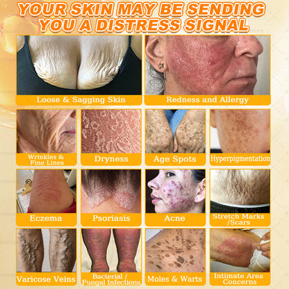 𝑯𝒊𝙢𝒊𝙡𝙠® 𝑩𝐞𝐞 𝑽𝙚𝙣𝙤𝙢 & 𝑻𝙖𝙡𝙡𝙤𝙬 𝑺𝐤𝐢𝐧 𝙍𝐞𝐬𝐭𝐨𝐫𝐚𝐭𝐢𝐨𝐧 𝘾𝐫𝐞𝐚𝐦 (Effective Within 7 Days)𝑩𝐞𝐞 𝑽𝙚𝙣𝙤𝙢 + 𝑻𝙖𝙡𝙡𝙤𝙬 · 7X Deep Hydration, targets wrinkles, sagging, stretch marks, dark spots, purpura, inflammations and more💧