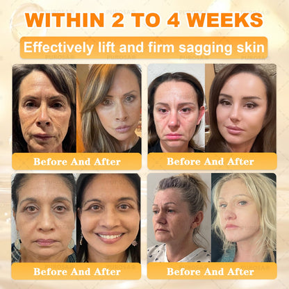 𝑯𝒊𝙢𝒊𝙡𝙠® 𝑩𝐞𝐞 𝑽𝙚𝙣𝙤𝙢 & 𝑻𝙖𝙡𝙡𝙤𝙬 𝑺𝐤𝐢𝐧 𝙍𝐞𝐬𝐭𝐨𝐫𝐚𝐭𝐢𝐨𝐧 𝘾𝐫𝐞𝐚𝐦 (Effective Within 7 Days)𝑩𝐞𝐞 𝑽𝙚𝙣𝙤𝙢 + 𝑻𝙖𝙡𝙡𝙤𝙬 · 7X Deep Hydration, targets wrinkles, sagging, stretch marks, dark spots, purpura, inflammations and more💧