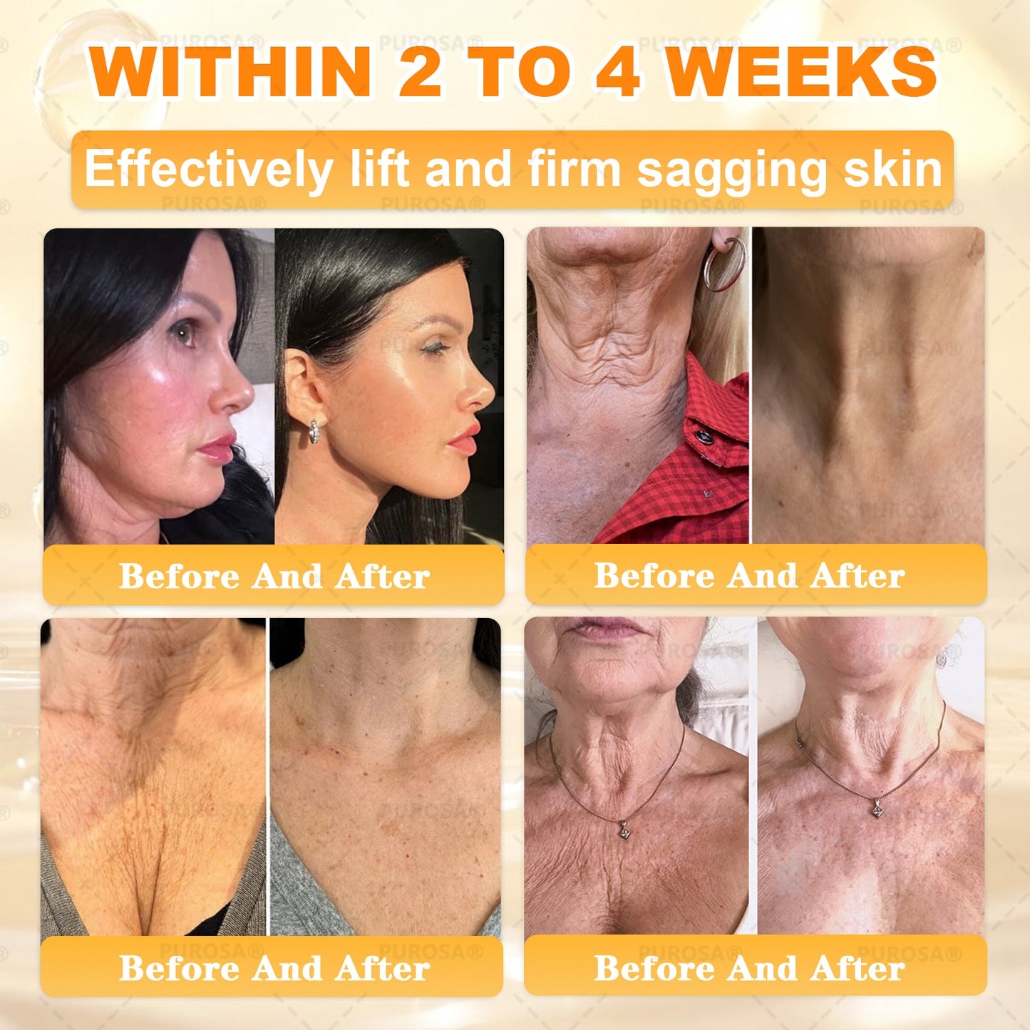 𝑯𝒊𝙢𝒊𝙡𝙠® 𝑩𝐞𝐞 𝑽𝙚𝙣𝙤𝙢 & 𝑻𝙖𝙡𝙡𝙤𝙬 𝑺𝐤𝐢𝐧 𝙍𝐞𝐬𝐭𝐨𝐫𝐚𝐭𝐢𝐨𝐧 𝘾𝐫𝐞𝐚𝐦 (Effective Within 7 Days)𝑩𝐞𝐞 𝑽𝙚𝙣𝙤𝙢 + 𝑻𝙖𝙡𝙡𝙤𝙬 · 7X Deep Hydration, targets wrinkles, sagging, stretch marks, dark spots, purpura, inflammations and more💧