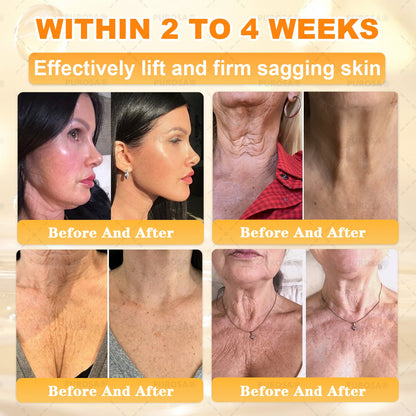 𝑯𝒊𝙢𝒊𝙡𝙠® 𝑩𝐞𝐞 𝑽𝙚𝙣𝙤𝙢 & 𝑻𝙖𝙡𝙡𝙤𝙬 𝑺𝐤𝐢𝐧 𝙍𝐞𝐬𝐭𝐨𝐫𝐚𝐭𝐢𝐨𝐧 𝘾𝐫𝐞𝐚𝐦 (Effective Within 7 Days)𝑩𝐞𝐞 𝑽𝙚𝙣𝙤𝙢 + 𝑻𝙖𝙡𝙡𝙤𝙬 · 7X Deep Hydration, targets wrinkles, sagging, stretch marks, dark spots, purpura, inflammations and more💧