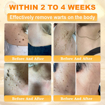 𝑯𝒊𝙢𝒊𝙡𝙠® 𝑩𝐞𝐞 𝑽𝙚𝙣𝙤𝙢 & 𝑻𝙖𝙡𝙡𝙤𝙬 𝑺𝐤𝐢𝐧 𝙍𝐞𝐬𝐭𝐨𝐫𝐚𝐭𝐢𝐨𝐧 𝘾𝐫𝐞𝐚𝐦 (Effective Within 7 Days)𝑩𝐞𝐞 𝑽𝙚𝙣𝙤𝙢 + 𝑻𝙖𝙡𝙡𝙤𝙬 · 7X Deep Hydration, targets wrinkles, sagging, stretch marks, dark spots, purpura, inflammations and more💧