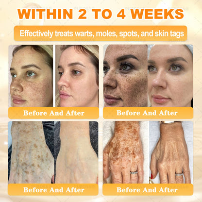 𝑯𝒊𝙢𝒊𝙡𝙠® 𝑩𝐞𝐞 𝑽𝙚𝙣𝙤𝙢 & 𝑻𝙖𝙡𝙡𝙤𝙬 𝑺𝐤𝐢𝐧 𝙍𝐞𝐬𝐭𝐨𝐫𝐚𝐭𝐢𝐨𝐧 𝘾𝐫𝐞𝐚𝐦 (Effective Within 7 Days)𝑩𝐞𝐞 𝑽𝙚𝙣𝙤𝙢 + 𝑻𝙖𝙡𝙡𝙤𝙬 · 7X Deep Hydration, targets wrinkles, sagging, stretch marks, dark spots, purpura, inflammations and more💧